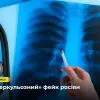 ​Російське вторгнення в Україну : Обережно, росіяни поширюють фейк про «епідемію туберкульозу в ЗСУ»