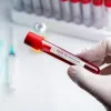На Дніпропетровщині за останню добу зафіксовано 31 новий випадок коронавірусної хвороби