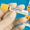«Потрібно вдвічі збільшити кількість тестувань на коронавірус» - заявив Максим Степанов
