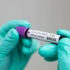 У Запоріжжі виявлено 4 людей з коронавірусом