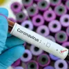 Україна отримала тест-систему для виявлення коронавірусу