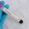 Іспанські органи охорони здоров’я виявили неякісну партію тестів на діагностування коронавірусу