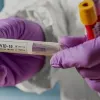 ​В Житомирській області з хворим на коронавірус контактувало 33 людини