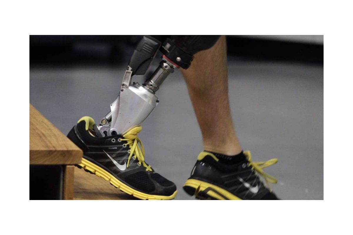 Прорив у виготовленні протезів Прорив у виготовленні протезів