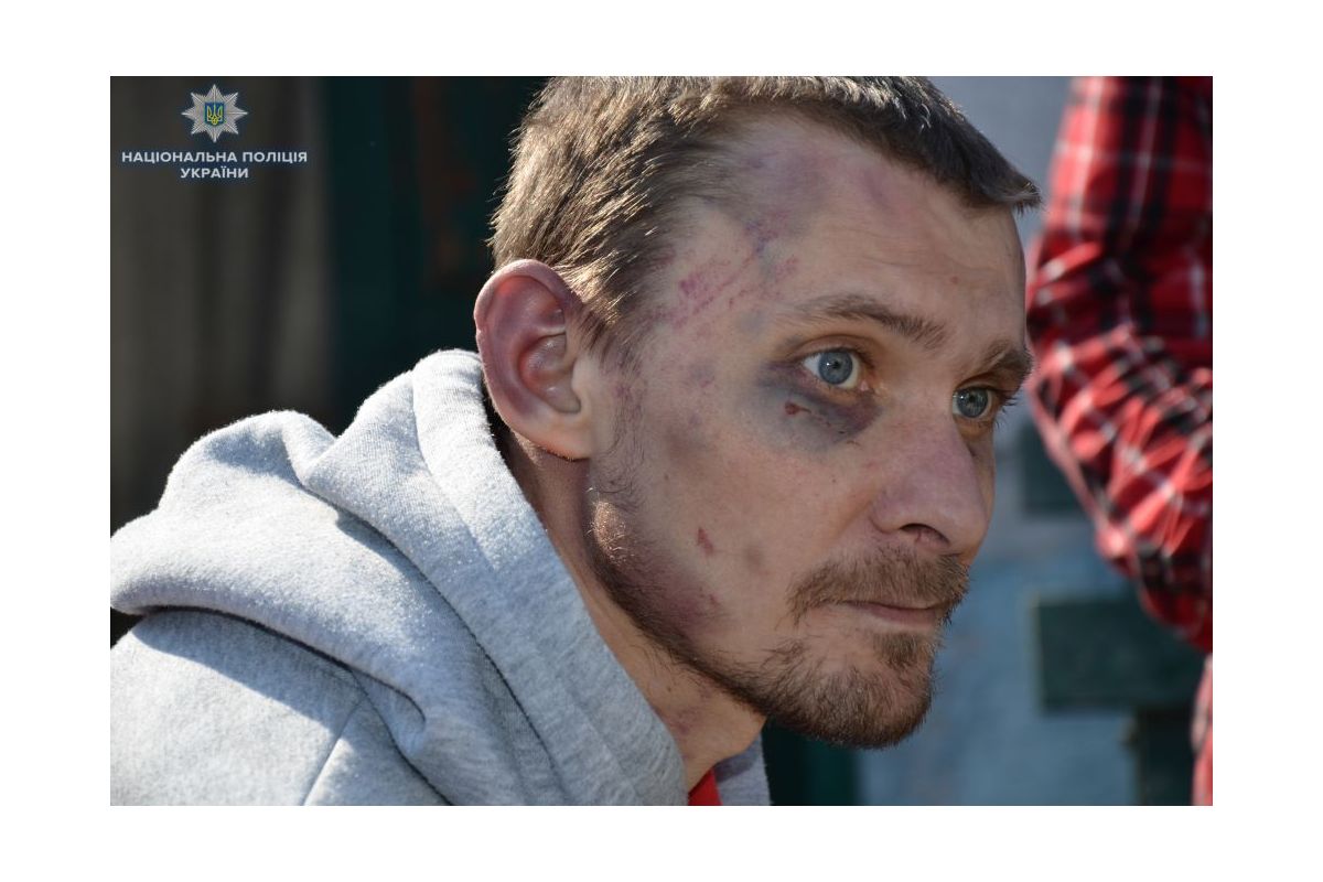 На Луганщині поліція виявила факт незаконного позбавлення волі та катування людей На Луганщині поліція виявила факт незаконного позбавлення волі та катування людей
