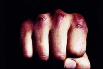 В Черновцах водитель авто убил пешехода из-за замечания о парковке 	  	 	    			 	  	В Черновцах водитель авто убил пешехода из-за замечания о парковке