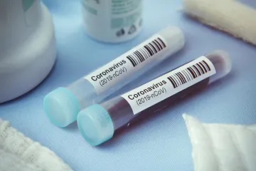 ​На Дніпропетровщині за добу виявлено три випадки коронавірусної хвороби