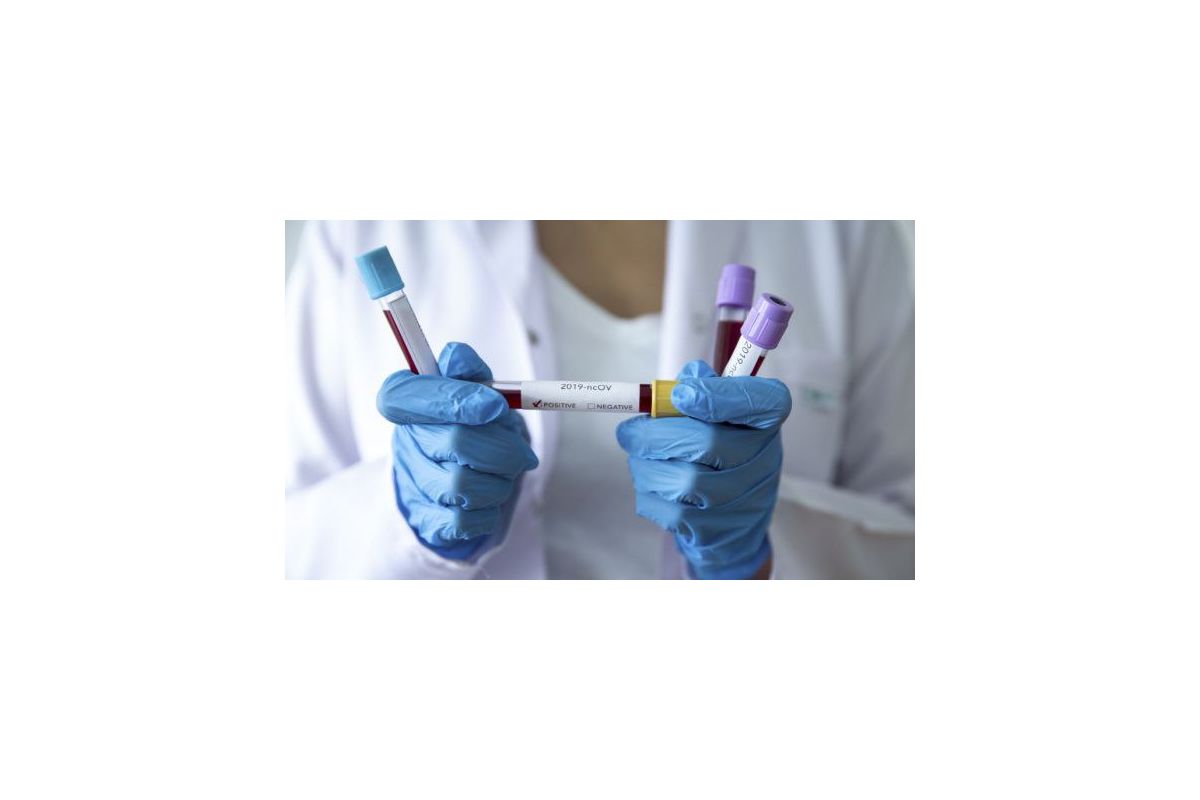 У Франції помер хворий на коронавірус громадянин України У Франції помер хворий на коронавірус громадянин України