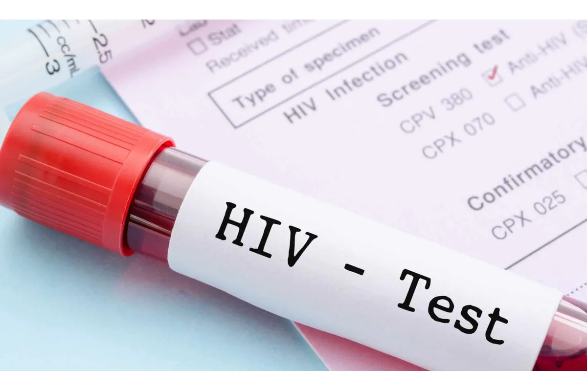 Кияни можуть пройти безкоштовну перевірку на ВІЛ
