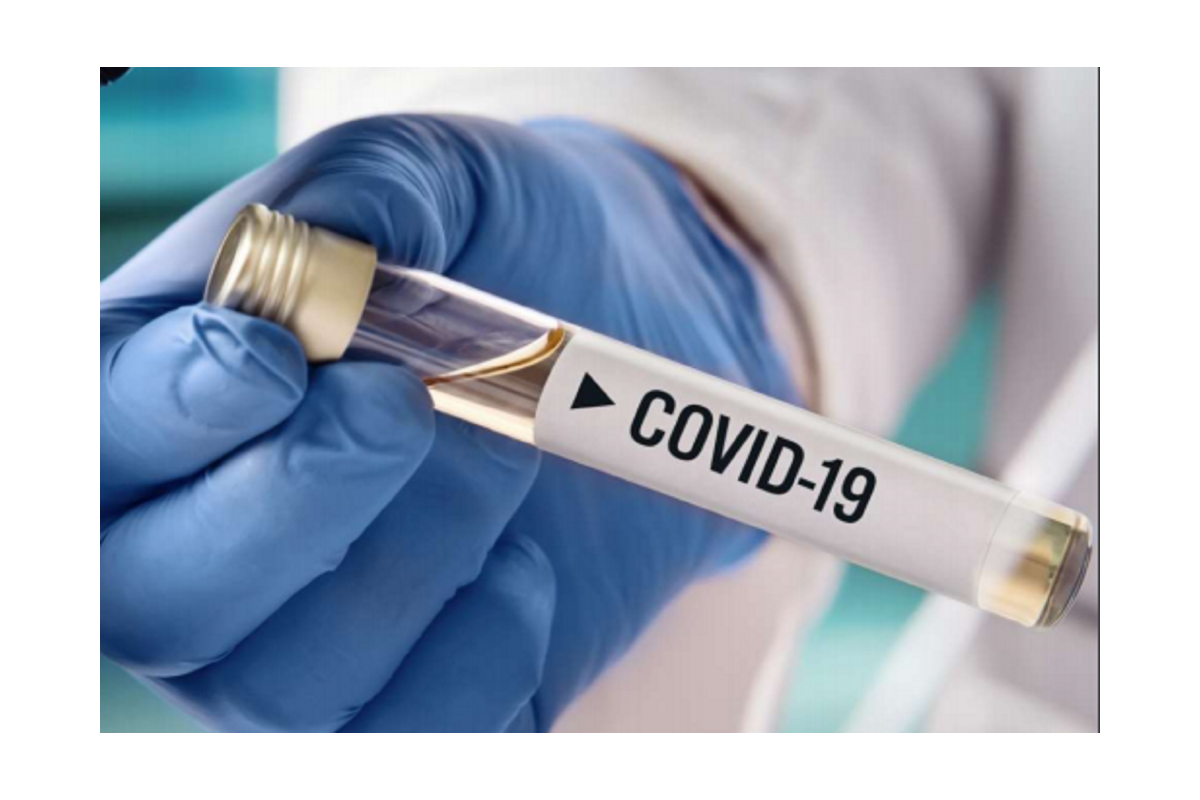 За минулу добу на Дніпропетровщині зафіксований 431 новий випадок COVID-19 За минулу добу на Дніпропетровщині зафіксований 431 новий випадок COVID-19