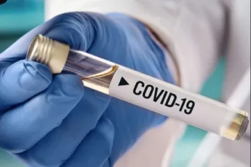 ​За минулу добу на Дніпропетровщині зафіксований 431 новий випадок COVID-19