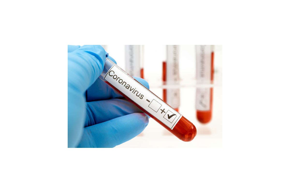 Щаслива чи сумна тиша коронавірусу у Мелітополі? Щаслива чи сумна тиша коронавірусу у Мелітополі?