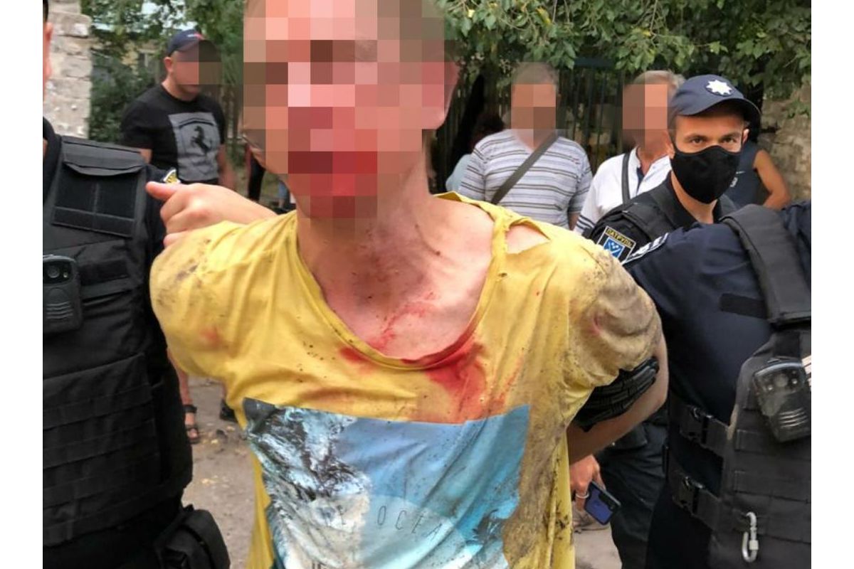 Підірвав через ревнощі: у Дніпрі чоловік кинув гранату в бік суперника Підірвав через ревнощі: у Дніпрі чоловік кинув гранату в бік суперника