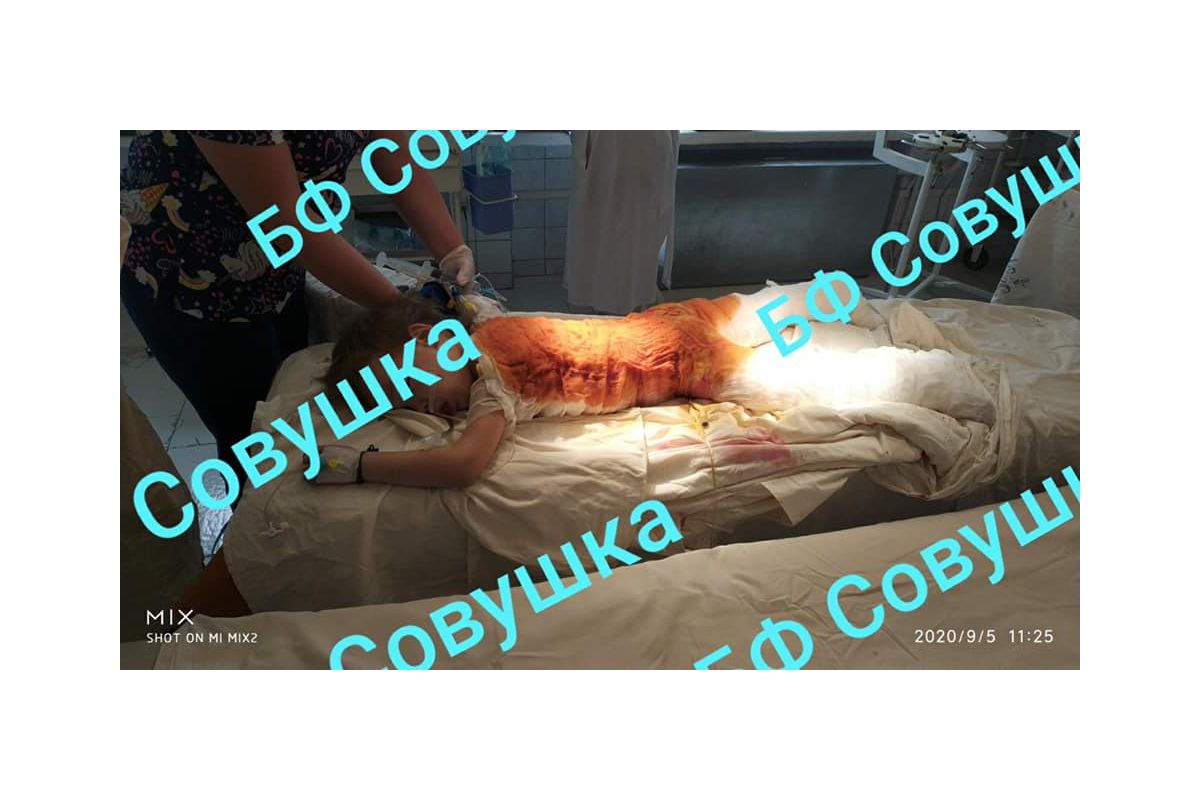 У Дніпрі рятують 4-річну дівчинку, яка отримала понад 50 відсотків опіків тіла У Дніпрі рятують 4-річну дівчинку, яка отримала понад 50 відсотків опіків тіла
