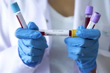 ​Добова кількість випадків коронавірусу на Дніпропетровщині перевищила триста