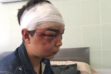 «Насиловали, вырывали ногти и избивали арматурой»: На Харьковщине двое мужчин жестоко пытали подростка 18+ «Насиловали, вырывали ногти и избивали арматурой»: На Харьковщине двое мужчин жестоко пытали подростка 18+