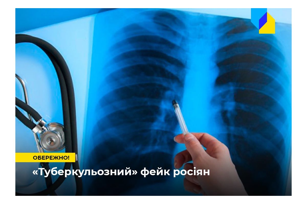 Російське вторгнення в Україну : Обережно, росіяни поширюють фейк про «епідемію туберкульозу в ЗСУ» Російське вторгнення в Україну : Обережно, росіяни поширюють фейк про «епідемію туберкульозу в ЗСУ»