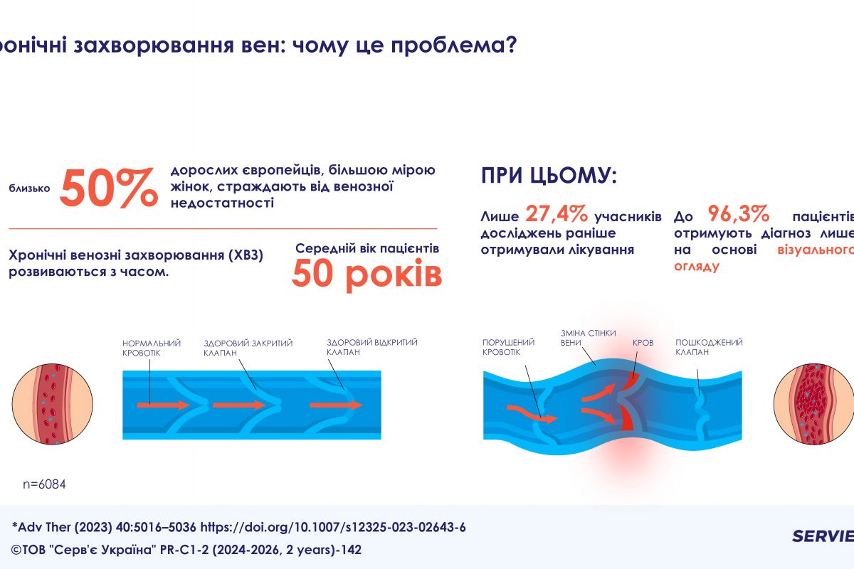 Міжнародне дослідження підтвердило ефективність консервативного лікування венозних захворювань Міжнародне дослідження підтвердило ефективність консервативного лікування венозних захворювань