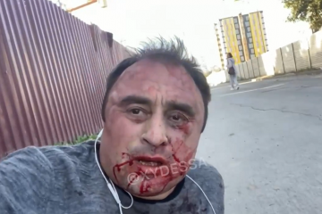 В Одессе избили соучредителя ресторана «Яхта» Сергея Кривенко В Одессе избили соучредителя ресторана «Яхта» Сергея Кривенко