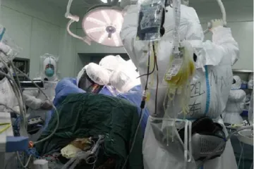 ​Пересадили легкие: в Ухане спасли пациента с тяжелой формой коронавируса 