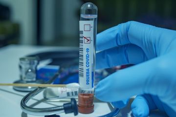 Ще 186 мешканців Дніпропетровщини заразилися коронавірусом Ще 186 мешканців Дніпропетровщини заразилися коронавірусом