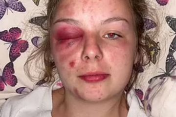 Жінка била себе молотком, щоб звинуватити чоловіків у зґвалтуванні Жінка била себе молотком, щоб звинуватити чоловіків у зґвалтуванні