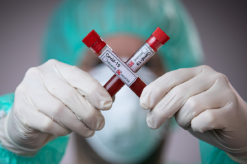 На Дніпропетровщині за добу виявлено 219 випадків COVID-19 На Дніпропетровщині за добу виявлено 219 випадків COVID-19