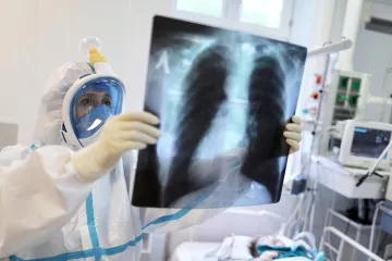 ​Інформаційне агентство : Пандемія COVID-19 викликала зростання смертності від туберкульозу