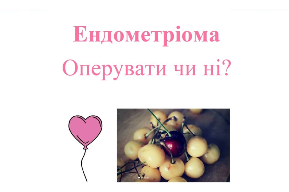 Ендометріома: Опирувати чи ні? Ендометріома: Опирувати чи ні?
