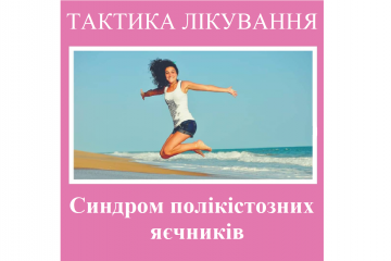 Репродуктолог Київ: Синдром полікістозних яєчників Репродуктолог Київ: Синдром полікістозних яєчників