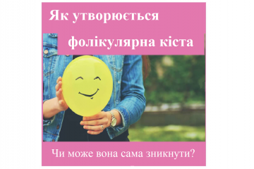 Репродуктолог Київ: Як утворюється фолікулярна кіста та чи може вона сама зникнути? Репродуктолог Київ: Як утворюється фолікулярна кіста та чи може вона сама зникнути?