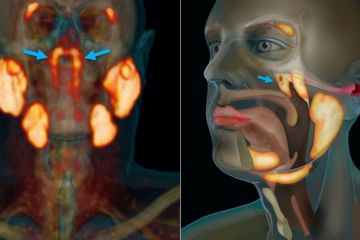 В голові людини виявили невідомий науці орган В голові людини виявили невідомий науці орган