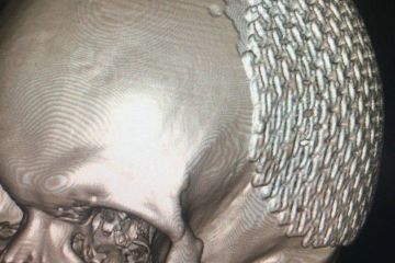 У лікарні Мечникова отямився боєць, який місяць був у комі У лікарні Мечникова отямився боєць, який місяць був у комі