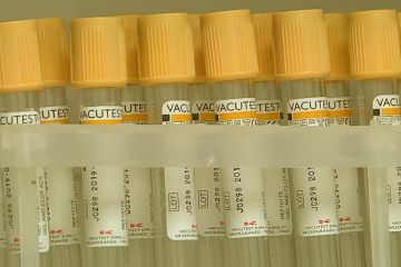 Вакцинація від кору, паротиту та краснухи тепер безкоштовна для усіх Вакцинація від кору, паротиту та краснухи тепер безкоштовна для усіх