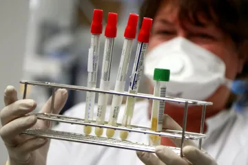 ​На Дніпропетровщині виявлено 15 нових випадків коронавірусної хвороби