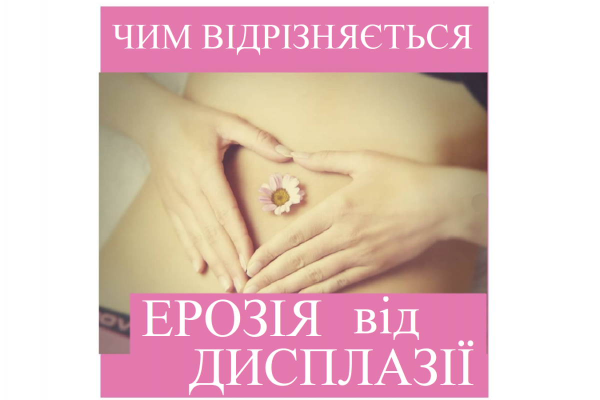 Репродуктолог Київ: Чим відрізняється ерозія від дисплазії? Репродуктолог Київ: Чим відрізняється ерозія від дисплазії?