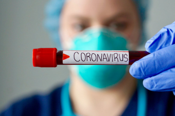 В Україні підтверджено 156 випадків COVID-19 В Україні підтверджено 156 випадків COVID-19