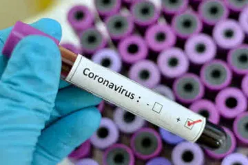 ​Україна отримала тест-систему для виявлення коронавірусу