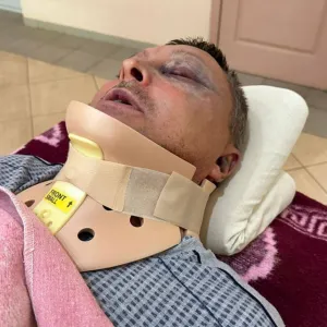 ​У Чорноморську група чоловіків напала на військового та зламала йому шию