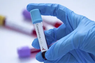 ​У Херсонській області виявлено першого пацієнта з коронавірусом