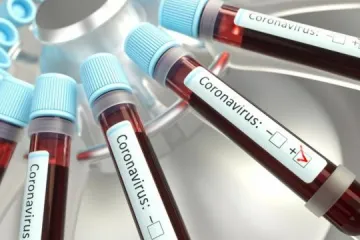 ​Росія визнала два перші летальні випадки від коронавірусу