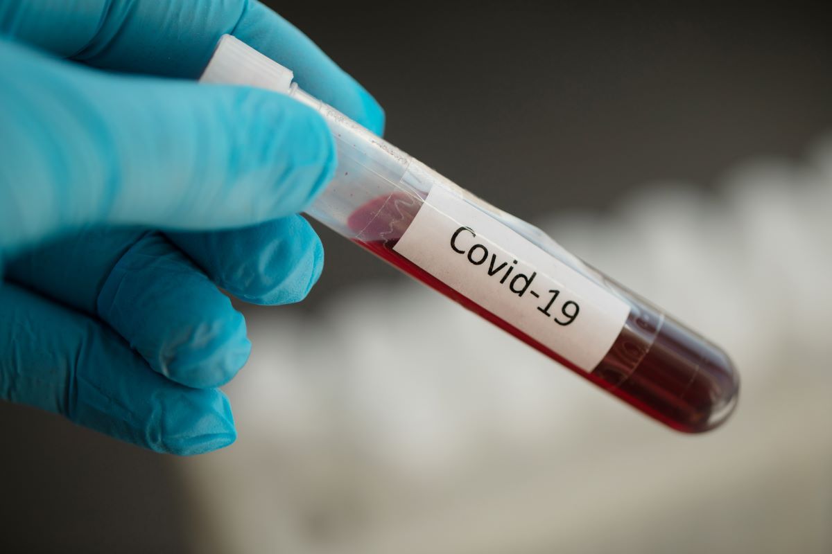В Україні за минулу добу — 807 нових випадків COVID-19 В Україні за минулу добу — 807 нових випадків COVID-19